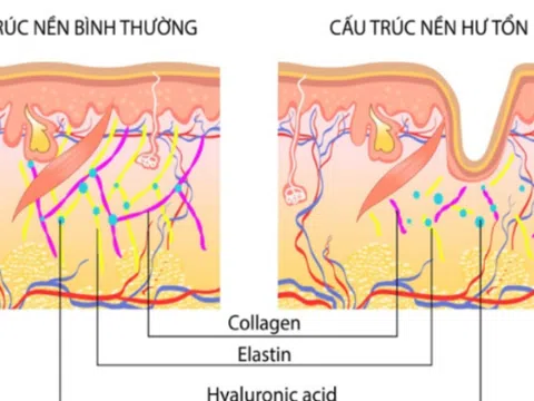 Ra mắt Chỉ Collagen K:OM công nghệ đặc biệt từ Nhật Bản - Tinh hoa chăm sóc da chuyên sâu 
