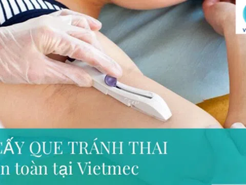 3 vấn đề chị em thường quan tâm về cấy que tránh thai