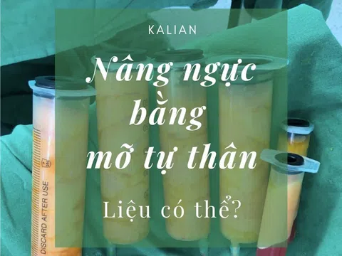 Ưu, nhược điểm của nâng ngực bằng mỡ tự thân