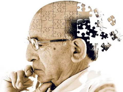 Phát triển công nghệ mới truyền thuốc trực tiếp vào não cho bệnh nhân Alzheimer