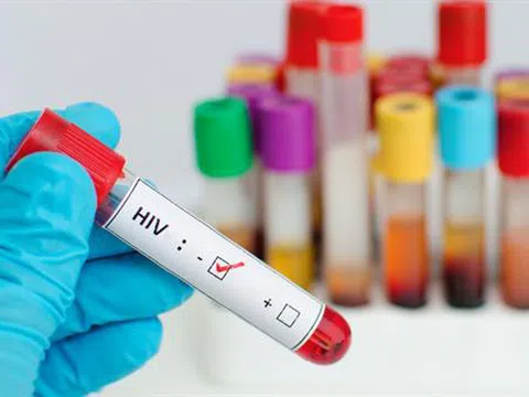 Nam Phi ra mắt thuốc điều trị HIV/AIDS hiệu quả cao