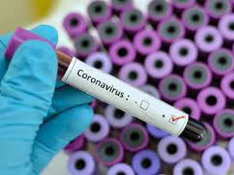 Hai sinh phẩm xét nghiệm SARS-CoV-2 được cấp số đăng ký