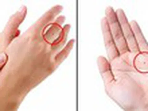 Nốt ruồi trên lòng bàn tay vị trí thứ 2 cả đời không lo túng thiếu