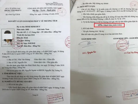 Đồng Nai: Nhiều dấu hiệu bất thường trong vụ án “Cố ý gây thương tích” cần làm rõ để dư luận bớt hoang mang