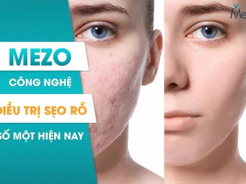 Hết sẹo, đẹp da công nghệ  Mezo được cấp bằng sáng chế tại Đức